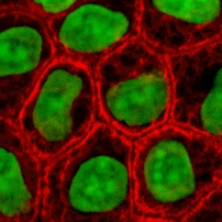 A sample of epithelial cells.